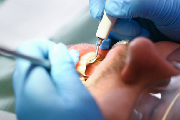 Best Emergency Treatment for Toothache in Sheffield, AL